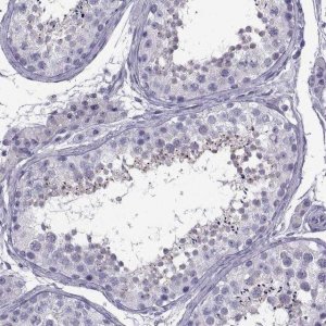 Anti-ARMC2 antibody produced in rabbit 