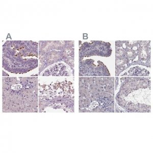 Anti-ARMC3 antibody produced in rabbit 