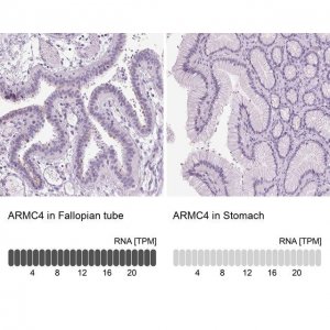 Anti-ARMC4 antibody produced in rabbit 