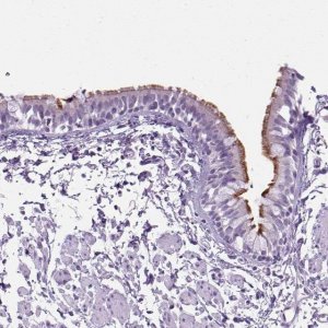 Anti-ARMC4 antibody produced in rabbit 