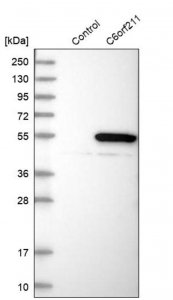 Anti-ARMT1 antibody produced in rabbit HPA005819-100UL
