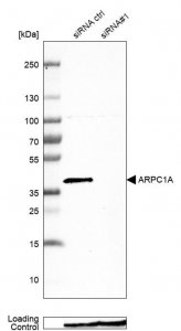 Anti-ARPC1A antibody produced in rabbit 