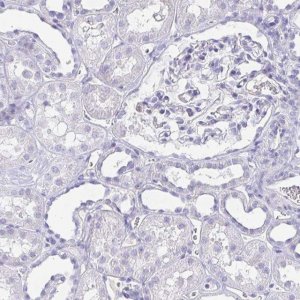 ANTI-ARPP21 antibody produced in rabbit 