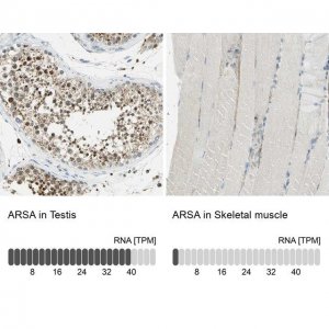 Anti-ARSA antibody produced in rabbit 