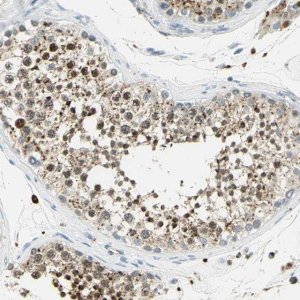 Anti-ARSA antibody produced in rabbit 