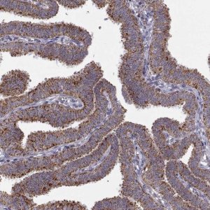 Anti-ARSD antibody produced in rabbit HPA004694-100UL