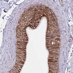 Anti-ARVCF antibody produced in rabbit 
