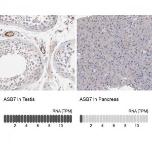 Anti-ASB7 antibody produced in rabbit 