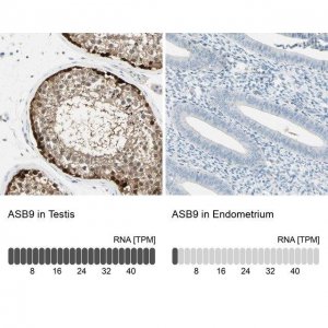 Anti-ASB9 antibody produced in rabbit HPA003014-100UL