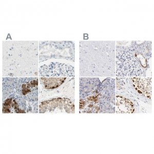 Anti-ASB9 antibody produced in rabbit HPA003014-100UL