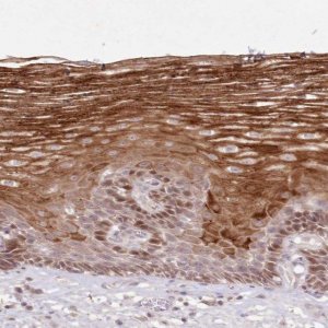 Anti-ASCC1 antibody produced in rabbit HPA038038-100UL