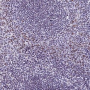 Anti-ASH2L antibody produced in rabbit 