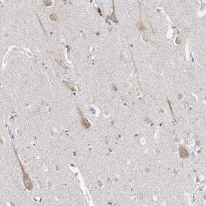 Anti-ASNS antibody produced in rabbit 