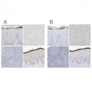 Anti-ASPRV1 antibody produced in rabbit 