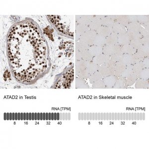 Anti-ATAD2 antibody produced in rabbit 