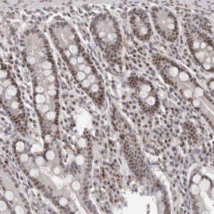 Anti-ATF5 antibody produced in rabbit 