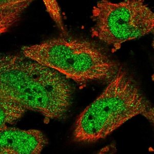 Anti-ATF5 antibody produced in rabbit 