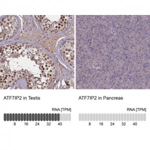 Anti-ATF7IP2 antibody produced in rabbit 
