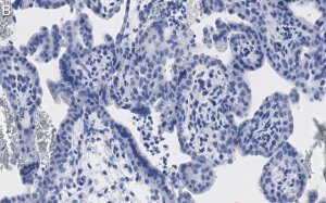 Anti-ATG7 Antibody, clone 1E15 ZooMAb Rabbit Monoclonal 