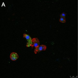 Anti-ATG8 Antibody, clone 2B11 ZooMAb Rabbit Monoclonal 