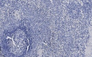 Anti-ATG9A Antibody, clone 5B11, ZooMAb Rabbit Monoclonal 