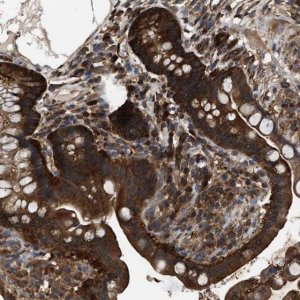 Anti-ATIC antibody produced in rabbit 