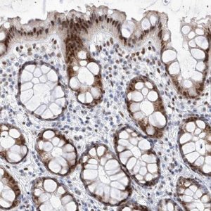 Anti-ATN1 antibody produced in rabbit 