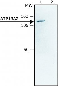 Anti-ATP13A2 (C-terminal) antibody produced in rabbit 