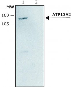 Anti-ATP13A2 antibody produced in rabbit 