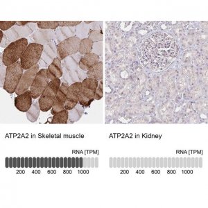 Anti-ATP2A2 antibody produced in rabbit 