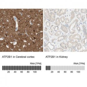 Anti-ATP2B1 antibody produced in rabbit HPA011166-100UL