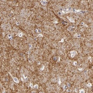 Anti-ATP2B3 antibody produced in rabbit 