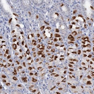 Anti-ATP4A antibody produced in rabbit 