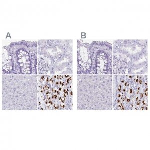 Anti-ATP4B antibody produced in rabbit 