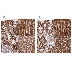 Anti-ATP5A1 antibody produced in rabbit HPA044202-100UL