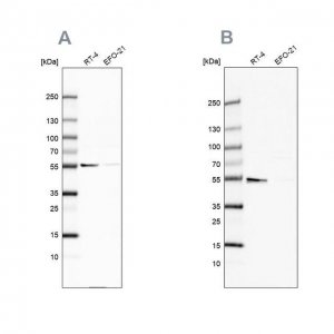 Anti-ATP5A1 antibody produced in rabbit HPA044202-100UL