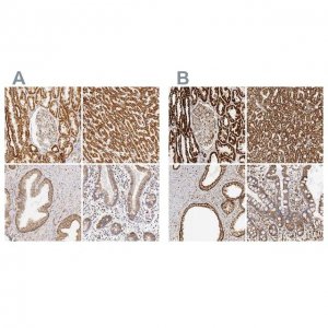 Anti-ATP5B antibody produced in rabbit 