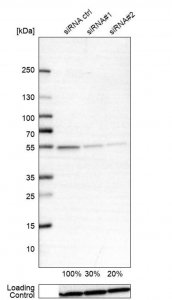 Anti-ATP5B antibody produced in rabbit 