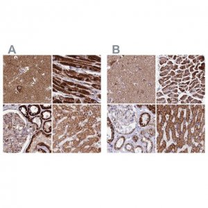 Anti-ATP5H antibody produced in rabbit HPA048459-100UL