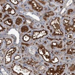 Anti-ATP6V0D1 antibody produced in rabbit 