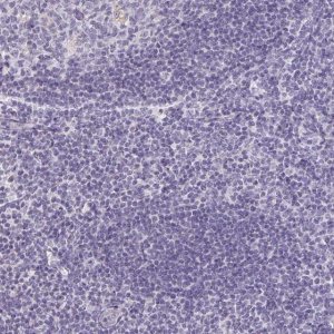 Anti-ATP6V0D2 antibody produced in rabbit HPA055327-100UL