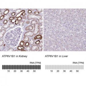 Anti-ATP6V1B1 antibody produced in rabbit 