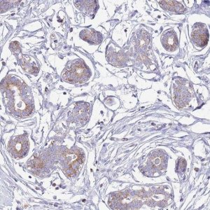 Anti-ATP6V1B1 antibody produced in rabbit 