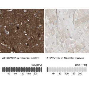 Anti-ATP6V1B2 antibody produced in rabbit 
