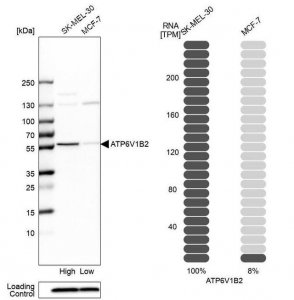 Anti-ATP6V1B2 antibody produced in rabbit 