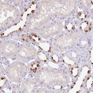 Anti-ATP6V1G3 antibody produced in rabbit 