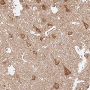 Anti-ATP8A1 antibody produced in rabbit 