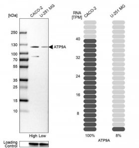 Anti-ATP9A antibody produced in rabbit HPA035630-100UL