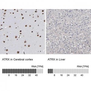 Anti-ATRX antibody produced in rabbit 