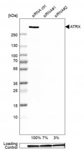 Anti-ATRX antibody produced in rabbit 
